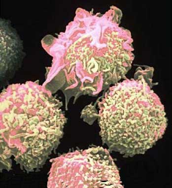 20110923015531-celulas-cancer.jpg