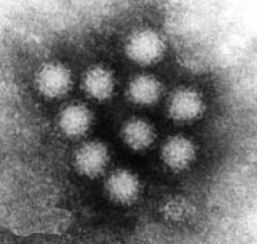 20130131155657-novovirus-media.jpg