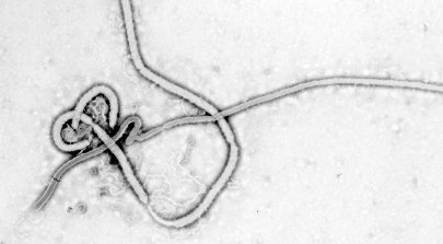 20140805182720-ebola-wikipedia-dominiopublico.jpg