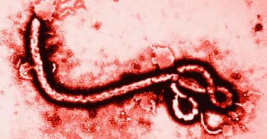 20140831143115-virus-ebola.jpg